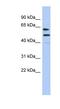 EZH Inhibitory Protein antibody, NBP1-70512, Novus Biologicals, Western Blot image 