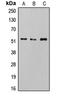 HsMAD2 antibody, LS-C354247, Lifespan Biosciences, Western Blot image 