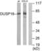 Dual specificity protein phosphatase 16 antibody, LS-C119242, Lifespan Biosciences, Western Blot image 