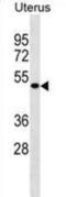 Multiciliate Differentiation And DNA Synthesis Associated Cell Cycle Protein antibody, abx030511, Abbexa, Western Blot image 