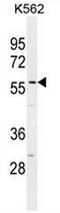 Smoothelin Like 1 antibody, AP53951PU-N, Origene, Western Blot image 