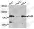 Dymeclin antibody, A8222, ABclonal Technology, Western Blot image 
