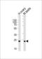 Phospholipase D6 antibody, LS-C163785, Lifespan Biosciences, Western Blot image 