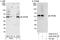 Vacuolar Protein Sorting 4 Homolog B antibody, A302-078A, Bethyl Labs, Immunoprecipitation image 