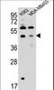 Sorting Nexin 29 antibody, LS-C161372, Lifespan Biosciences, Western Blot image 