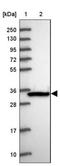 Lactate Dehydrogenase C antibody, NBP1-92065, Novus Biologicals, Western Blot image 