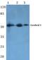 Ribosomal RNA-processing protein 8 antibody, PA5-36441, Invitrogen Antibodies, Western Blot image 