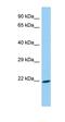 Ankyrin Repeat And SOCS Box Containing 18 antibody, orb326703, Biorbyt, Western Blot image 