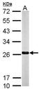 NRH:quinone oxidoreductase 2 antibody, NBP1-31563, Novus Biologicals, Western Blot image 