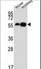 Aromatic-L-amino-acid decarboxylase antibody, LS-C167316, Lifespan Biosciences, Western Blot image 
