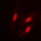 Catenin Beta 1 antibody, LS-C353985, Lifespan Biosciences, Immunofluorescence image 