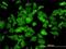 3'(2'), 5'-Bisphosphate Nucleotidase 1 antibody, H00010380-M01, Novus Biologicals, Immunocytochemistry image 