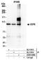E2F Transcription Factor 8 antibody, A303-039A, Bethyl Labs, Immunoprecipitation image 