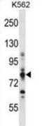 Carnitine Palmitoyltransferase 1A antibody, abx028215, Abbexa, Western Blot image 