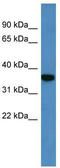2,4-Dienoyl-CoA Reductase 2 antibody, TA331824, Origene, Western Blot image 