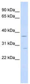 Interferon Gamma Receptor 2 antibody, TA339011, Origene, Western Blot image 