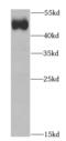 Intraflagellar Transport 52 antibody, FNab04159, FineTest, Western Blot image 