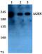 Agrin antibody, A04649-1, Boster Biological Technology, Western Blot image 