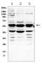 Galactosamine (N-Acetyl)-6-Sulfatase antibody, A02954-1, Boster Biological Technology, Western Blot image 