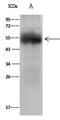 Alpha-1-antiproteinase antibody, GTX02371, GeneTex, Immunoprecipitation image 