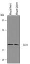 C-C Motif Chemokine Receptor 1 antibody, AF5986, R&D Systems, Western Blot image 