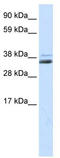 Secreted frizzled-related protein 1 antibody, TA330411, Origene, Western Blot image 