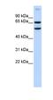 RELB Proto-Oncogene, NF-KB Subunit antibody, orb330018, Biorbyt, Western Blot image 