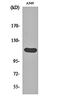 Fibroblast Growth Factor Receptor 2 antibody, orb160118, Biorbyt, Western Blot image 