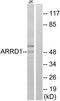 Arrestin domain-containing protein 1 antibody, TA315990, Origene, Western Blot image 