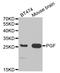 Placenta growth factor antibody, TA332424, Origene, Western Blot image 