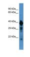 Chromaffin granule amine transporter antibody, orb326247, Biorbyt, Western Blot image 