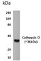 Cathepsin K antibody, GTX52582, GeneTex, Western Blot image 