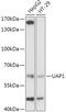 UDP-N-acetylhexosamine pyrophosphorylase antibody, GTX64787, GeneTex, Western Blot image 