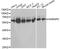 Heterogeneous nuclear ribonucleoprotein K antibody, A1701, ABclonal Technology, Western Blot image 