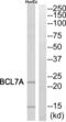 BAF Chromatin Remodeling Complex Subunit BCL7A antibody, abx015118, Abbexa, Western Blot image 