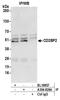 CD2 Cytoplasmic Tail Binding Protein 2 antibody, A304-827A, Bethyl Labs, Immunoprecipitation image 