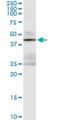 Serine/threonine-protein kinase 19 antibody, H00008859-M01, Novus Biologicals, Immunoprecipitation image 