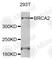 BRCA2 antibody, A2435, ABclonal Technology, Western Blot image 