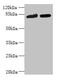 DDHD Domain Containing 2 antibody, CSB-PA006586LA01HU, Cusabio, Western Blot image 