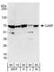 CaRF antibody, A303-861A, Bethyl Labs, Western Blot image 