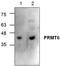 Protein Arginine Methyltransferase 6 antibody, TA318867, Origene, Western Blot image 