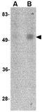 ORAI Calcium Release-Activated Calcium Modulator 1 antibody, GTX17289, GeneTex, Western Blot image 