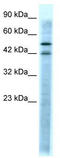 5-Hydroxytryptamine Receptor 3A antibody, TA329996, Origene, Western Blot image 