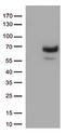 Matrix Metallopeptidase 2 antibody, CF806847, Origene, Western Blot image 