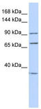 Eukaryotic Translation Elongation Factor 2 antibody, TA344333, Origene, Western Blot image 
