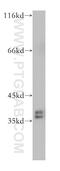 Heterogeneous Nuclear Ribonucleoprotein A2/B1 antibody, 14813-1-AP, Proteintech Group, Western Blot image 