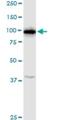 Ring Finger Protein 111 antibody, H00054778-D01P, Novus Biologicals, Western Blot image 