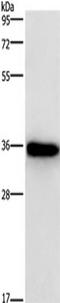  antibody, TA350935, Origene, Western Blot image 
