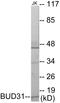 BUD31 Homolog antibody, EKC1719, Boster Biological Technology, Western Blot image 