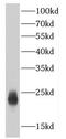 Chromosome 7 Open Reading Frame 50 antibody, FNab01137, FineTest, Western Blot image 